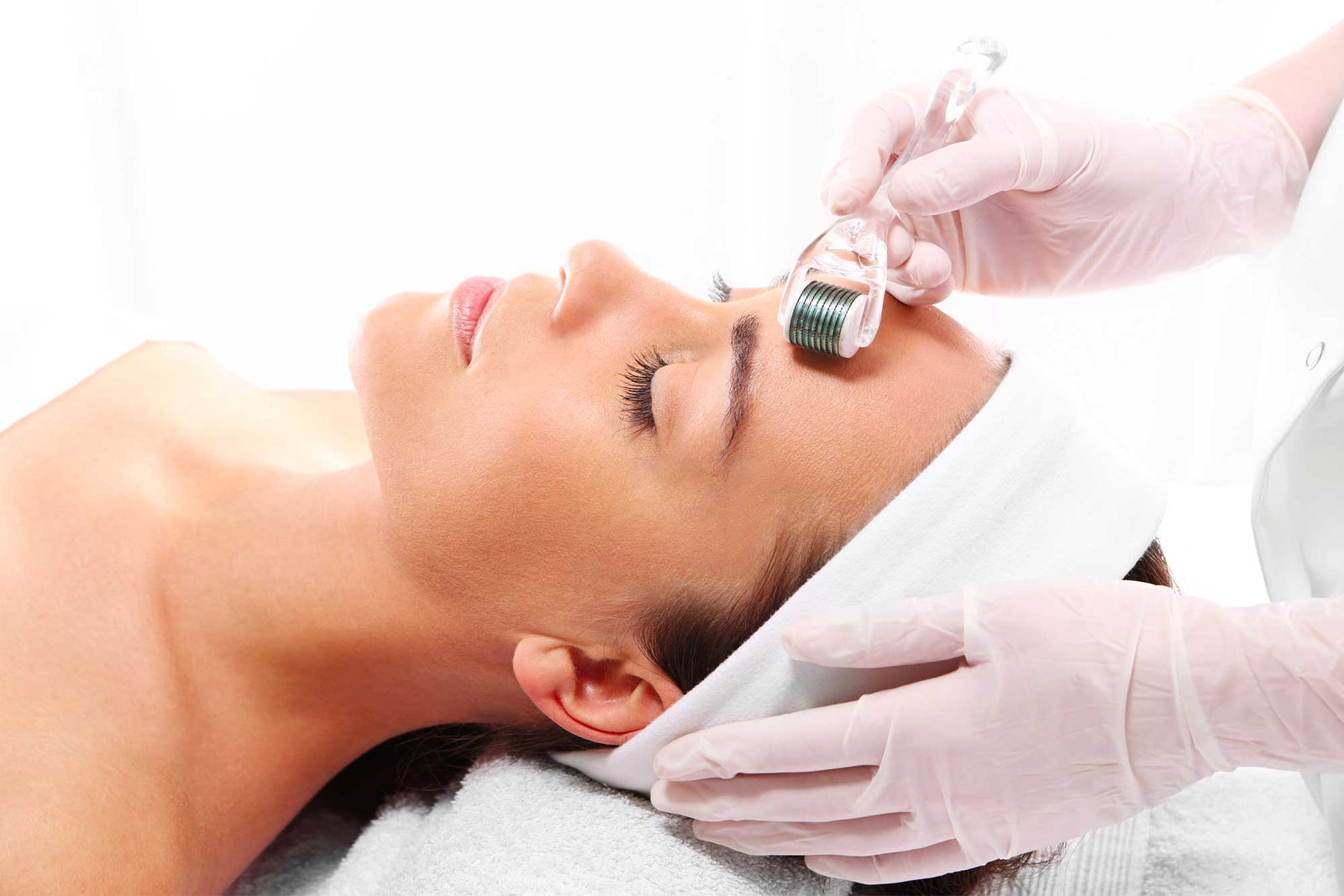 Microneedling